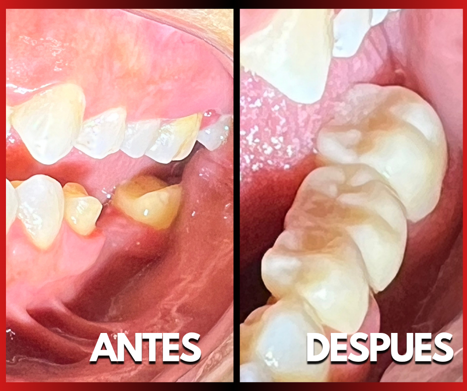 Imagen 2